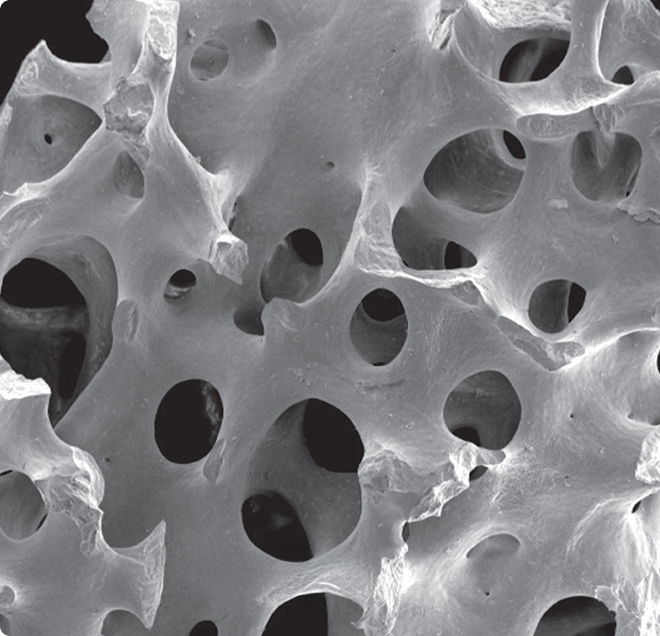 Easy Bone Graft