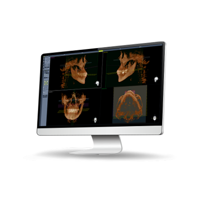 Dentium 3D Viewer