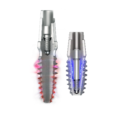 bright Implant